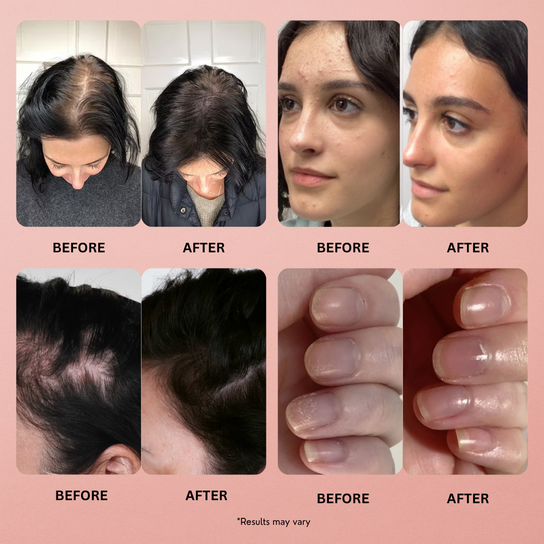 Refine Glow - Hair, Skin and Nail Gummies