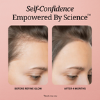 Refine Glow - Hair, Skin and Nail Gummies