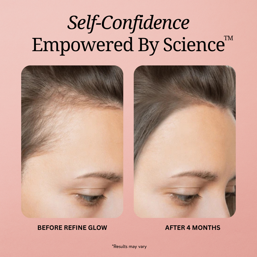 Refine Glow - Hair, Skin and Nail Gummies